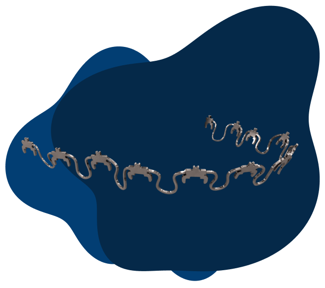 Closeup of InSmile lingual wire braces