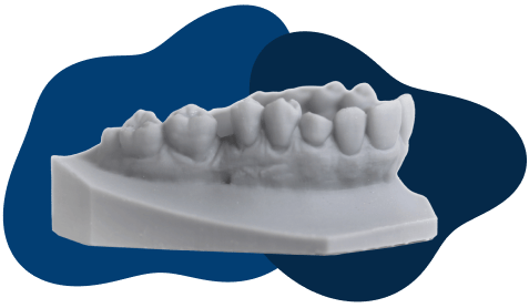 3D model of lower jaw